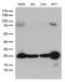 O-6-Methylguanine-DNA Methyltransferase antibody, LS-C794779, Lifespan Biosciences, Western Blot image 