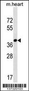 F-Box Protein 22 antibody, 60-086, ProSci, Western Blot image 