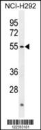 Actin Like 7A antibody, 55-197, ProSci, Western Blot image 