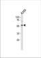 Zinc finger protein with KRAB and SCAN domains 4 antibody, TA324643, Origene, Western Blot image 