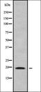 Carcinoembryonic Antigen Related Cell Adhesion Molecule 19 antibody, orb338140, Biorbyt, Western Blot image 