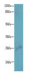 RAB32, Member RAS Oncogene Family antibody, A64730-100, Epigentek, Western Blot image 