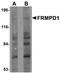 FERM And PDZ Domain Containing 1 antibody, A10887, Boster Biological Technology, Western Blot image 