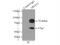 Diacylglycerol O-Acyltransferase 1 antibody, 11561-1-AP, Proteintech Group, Immunoprecipitation image 