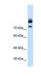 Myotubularin Related Protein 1 antibody, NBP1-55486, Novus Biologicals, Western Blot image 