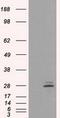 Prolactin antibody, GTX83802, GeneTex, Western Blot image 