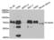 Twinkle protein, mitochondrial antibody, LS-C333968, Lifespan Biosciences, Western Blot image 