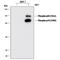 Ribosomal Protein S6 Kinase B1 antibody, MAB8963, R&D Systems, Western Blot image 