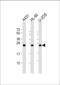 RAB5C, Member RAS Oncogene Family antibody, MA5-24745, Invitrogen Antibodies, Western Blot image 