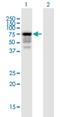 Iduronate 2-Sulfatase antibody, H00003423-B01P, Novus Biologicals, Western Blot image 