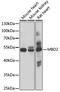 Methyl-CpG Binding Domain Protein 2 antibody, 18-585, ProSci, Western Blot image 