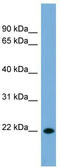 CD8b Molecule antibody, TA346387, Origene, Western Blot image 