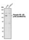 Nuclear Factor Kappa B Subunit 2 antibody, PA5-17385, Invitrogen Antibodies, Western Blot image 