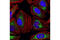 Succinate Dehydrogenase Complex Flavoprotein Subunit A antibody, 5839S, Cell Signaling Technology, Immunofluorescence image 