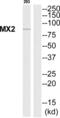 MX Dynamin Like GTPase 2 antibody, abx015097, Abbexa, Western Blot image 