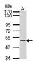 Zinc Finger C3HC-Type Containing 1 antibody, PA5-29367, Invitrogen Antibodies, Western Blot image 