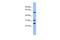 Proteasome 26S Subunit, ATPase 4 antibody, PA5-44602, Invitrogen Antibodies, Western Blot image 