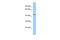 Phosphatidylinositol Glycan Anchor Biosynthesis Class U antibody, PA5-69681, Invitrogen Antibodies, Western Blot image 