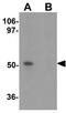 Proline Rich 5 Like antibody, GTX31835, GeneTex, Western Blot image 