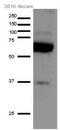 Serine/threonine-protein kinase PINK1, mitochondrial antibody, ab23707, Abcam, Western Blot image 