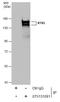 Reticulon 3 antibody, GTX131091, GeneTex, Immunoprecipitation image 