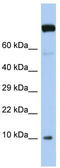 Transcription Elongation Factor A Like 9 antibody, TA335563, Origene, Western Blot image 