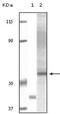 AKT Serine/Threonine Kinase 3 antibody, abx010372, Abbexa, Enzyme Linked Immunosorbent Assay image 