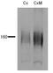 Solute Carrier Family 12 Member 3 antibody, GTX41969, GeneTex, Western Blot image 