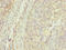 Apurinic/Apyrimidinic Endodeoxyribonuclease 1 antibody, LS-C285451, Lifespan Biosciences, Immunohistochemistry paraffin image 