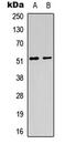 Acetylcholine Receptor antibody, GTX56224, GeneTex, Western Blot image 
