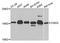 CDGSH Iron Sulfur Domain 2 antibody, A5231, ABclonal Technology, Western Blot image 