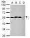 RuvB Like AAA ATPase 1 antibody, NBP2-20244, Novus Biologicals, Western Blot image 