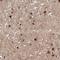 Signal Induced Proliferation Associated 1 Like 1 antibody, HPA002875, Atlas Antibodies, Immunohistochemistry paraffin image 