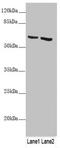 Keratin 6B antibody, LS-C675973, Lifespan Biosciences, Western Blot image 