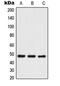 Thyroid Hormone Receptor Interactor 13 antibody, LS-C353156, Lifespan Biosciences, Western Blot image 