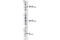 Non-receptor tyrosine-protein kinase TNK1 antibody, 4553S, Cell Signaling Technology, Western Blot image 