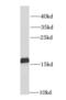 NPC Intracellular Cholesterol Transporter 2 antibody, FNab05813, FineTest, Western Blot image 