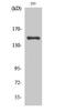 Ankyrin Repeat Domain 30A antibody, STJ91597, St John