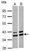 Aldo-Keto Reductase Family 1 Member A1 antibody, GTX102159, GeneTex, Western Blot image 