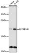 Protein Phosphatase 1 Regulatory Inhibitor Subunit 14B antibody, A14677, ABclonal Technology, Western Blot image 