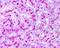 Autophagy Related 5 antibody, NB110-53818, Novus Biologicals, Immunohistochemistry frozen image 