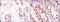 Protein Kinase, DNA-Activated, Catalytic Subunit antibody, NBP2-22128, Novus Biologicals, Immunohistochemistry paraffin image 