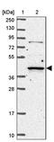 Ras association domain-containing protein 2 antibody, PA5-62344, Invitrogen Antibodies, Western Blot image 