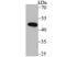 Damage Specific DNA Binding Protein 2 antibody, NBP2-75718, Novus Biologicals, Western Blot image 