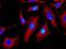 Cathepsin B antibody, ab125067, Abcam, Immunocytochemistry image 