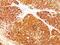 Melanoma Marker antibody, NBP2-48258, Novus Biologicals, Immunohistochemistry paraffin image 