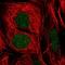 General Transcription Factor IIE Subunit 1 antibody, NBP2-57280, Novus Biologicals, Immunocytochemistry image 