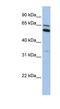 Chromosome 2 Open Reading Frame 42 antibody, NBP1-70466, Novus Biologicals, Western Blot image 