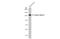 Integrin Subunit Alpha 8 antibody, GTX133648, GeneTex, Western Blot image 
