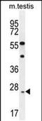 Rhophilin Associated Tail Protein 1 Like antibody, PA5-48294, Invitrogen Antibodies, Western Blot image 